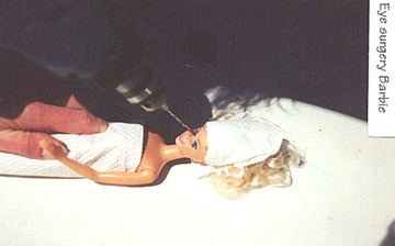 Eye_Surgery_Barbie